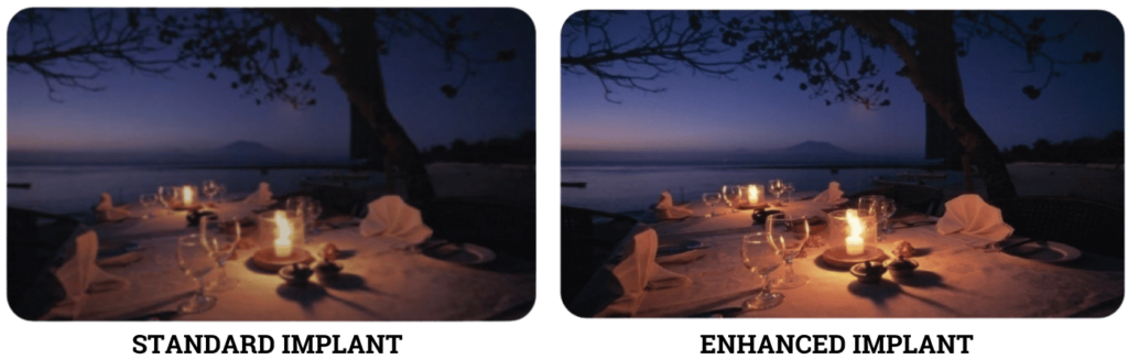 Illustration comparing intraocular lens types