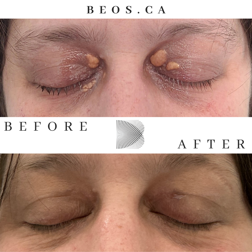 BA18 before and after comparison